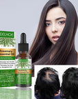 EELHOE Rosemary Essential Oil For Hair Growth 30ml