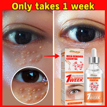 Fat Granules Removal Serum Fade Dark Circles Eye Bags Wrinkles  Care