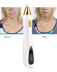 Skin Care Laser Mole Tattoo Freckle Removal Pen