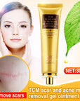 Stretch Marks Remove Acne Scar Treatment Cream