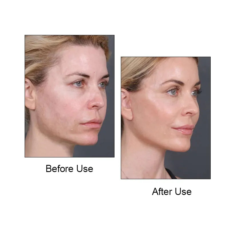 Wholesale Cheap V Face Chin Bandage – Facial Lifting & Jawline Contouring Band