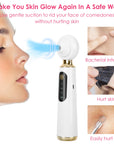 Blackhead Vacuum Remover Electric Acne Blackhead Comedone Extractor Remover Tool Facial Pore Cleaner Pimple Suction Tool