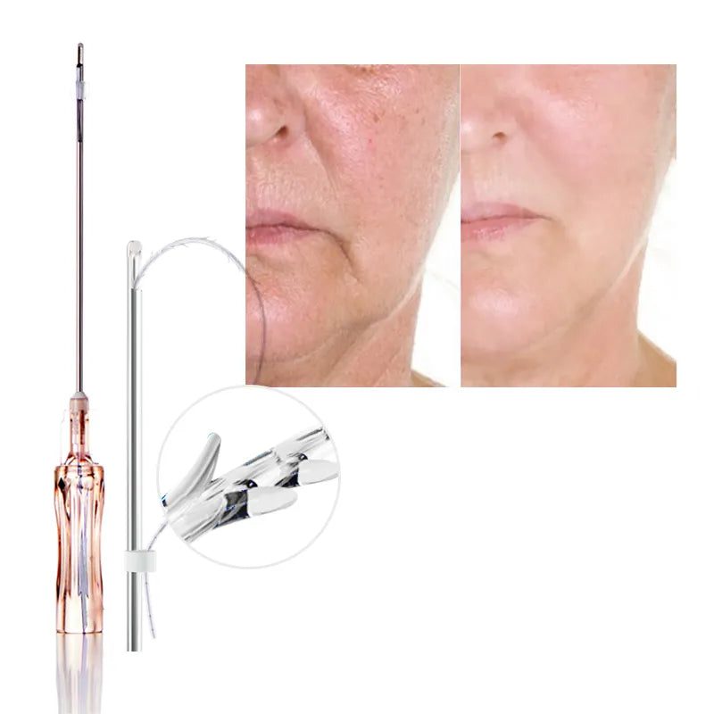 Long Effect Anti-Aging PCL Cog 6D Lifting Thread – Advanced Non-Surgical Facial Lifting & Collagen Stimulation