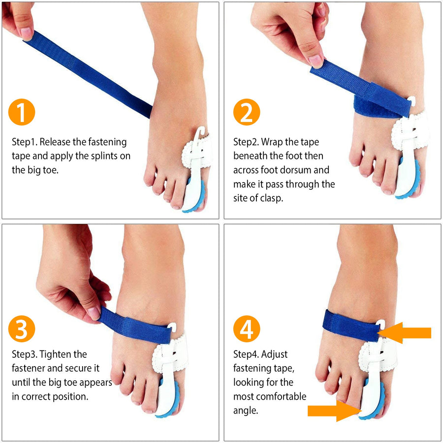 Bunion Corrector Night Time Bunion Splints Bunion Relief Protector Sleeves Kit For Bending Toe Overlapping Toe Hallux Valgus