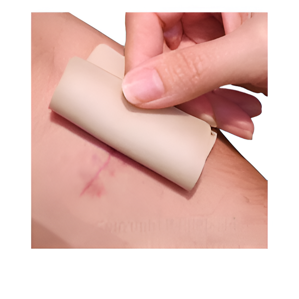 Visco-GEL Silicone Scar Sheet 4x6 – Clear Top Cover, Reusable