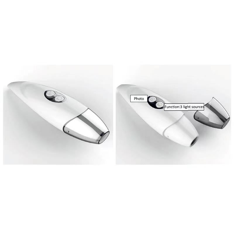 ScalpSense Pro scalp diagnostic device