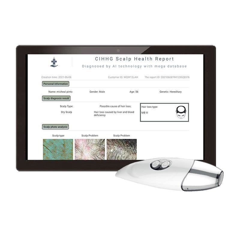 ScalpSense Pro scalp diagnostic device