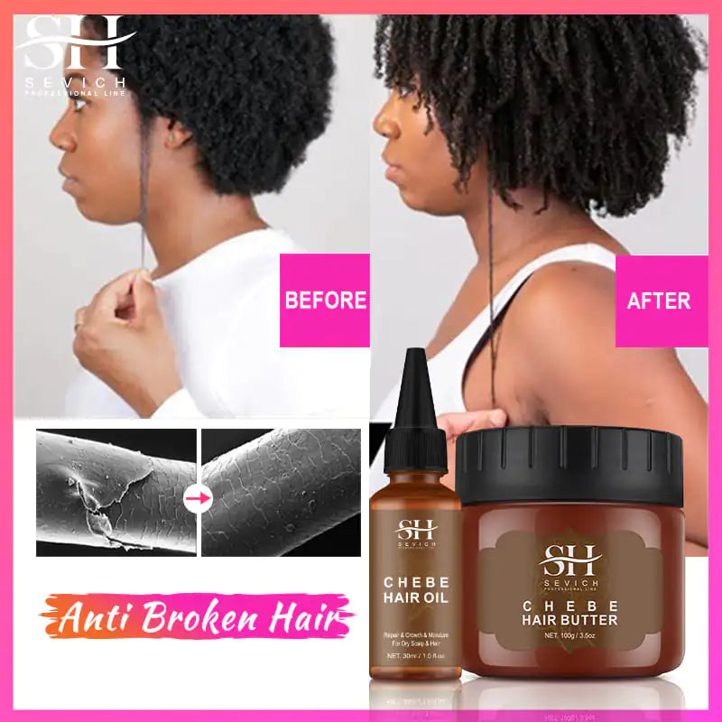 Skin Help Zone SEVICH African  Chebe Hair Growth Spray