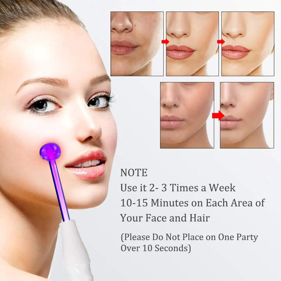 High Frequency Acne Wand 7-in-1