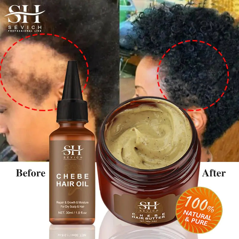 Skin Help Zone SEVICH African  Chebe Hair Growth Spray