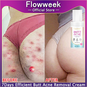 Flow Week Butt Acne Clearing Spot Treatment Cream 48gm