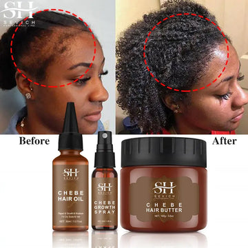 Skin Help Zone SEVICH African  Chebe Hair Growth Spray
