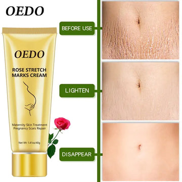 OEDO Rose Stretch Mark Cream Maternity Skin Treatment Pregnancy Scars Repair 40g